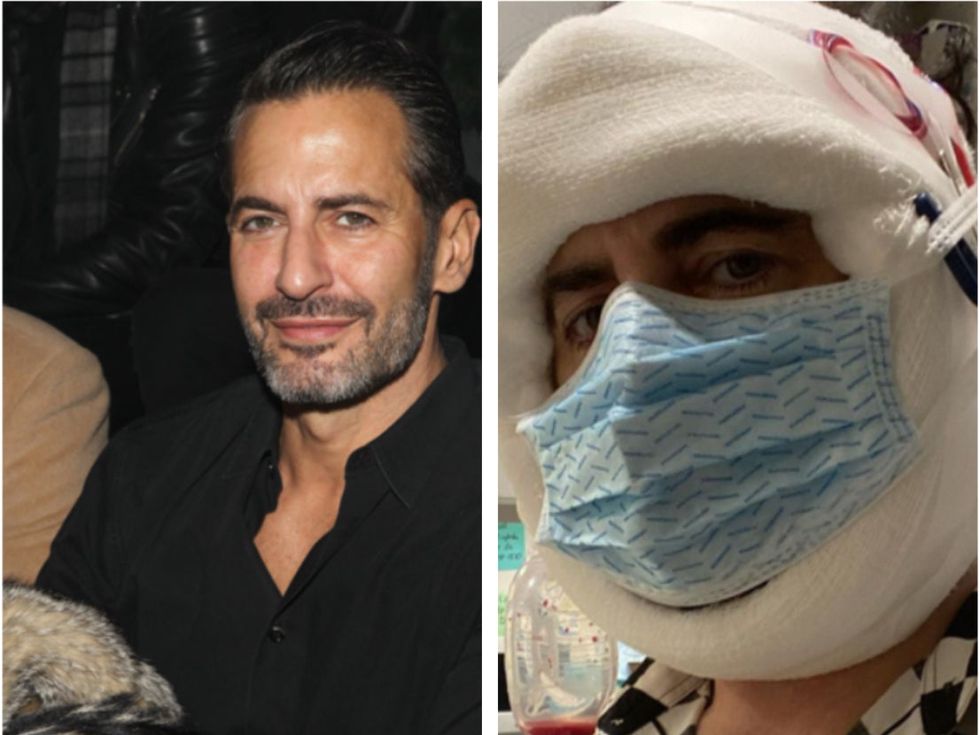 Marc Jacobs, 58, opens up about his $50,000 facelift and why he's sharing  post-op photos