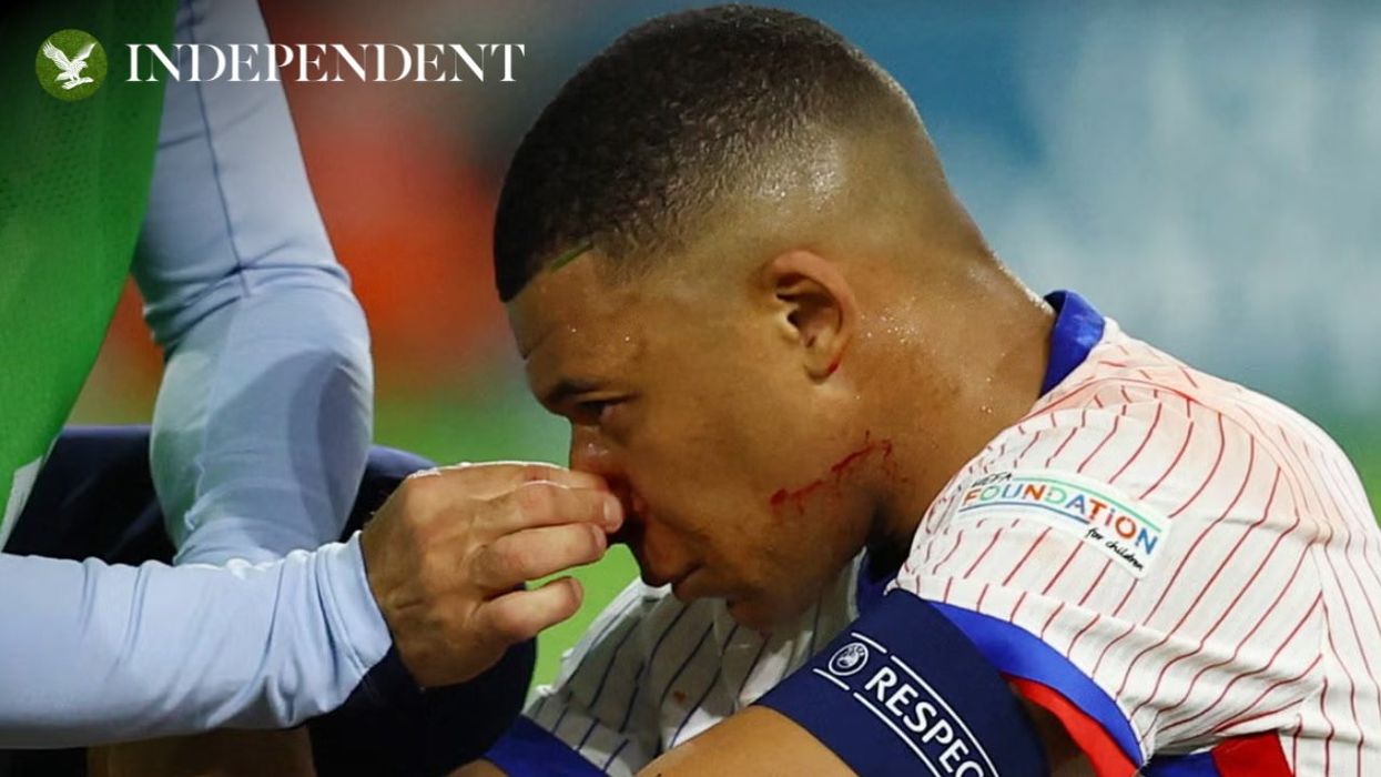 Kylian Mbappe asks for 'mask ideas' after breaking nose at Euro 2024
